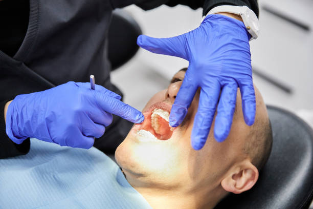 Best Emergency Dental Extractions in Benavides, TX
