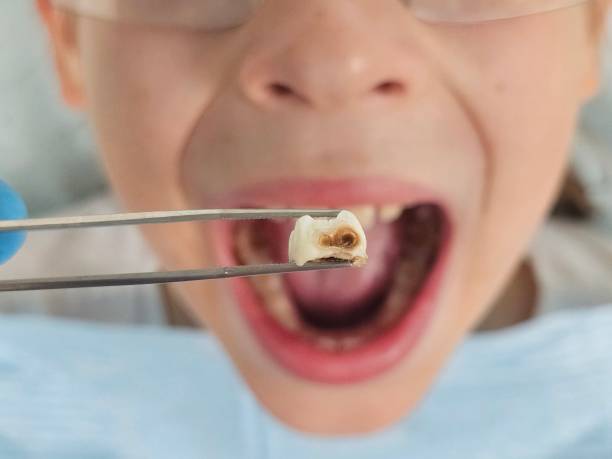 Best Mobile Emergency Dentist in Benavides, TX